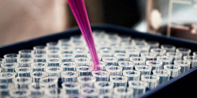 Πολλαπλούν μυέλωμα: 25 κλινικές μελέτες στο Κέντρο Αναφοράς στην Αθήνα