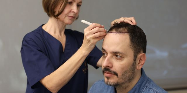 Seneca Medical Group: Η μεταμόσχευση μαλλιών δεν είναι ταμπού, είναι αυτοφροντίδα