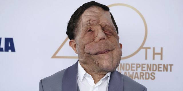 Το “The Elephant Man” ξανά στην μεγάλη οθόνη με πρωταγωνιστή τον Άνταμ Πίρσον