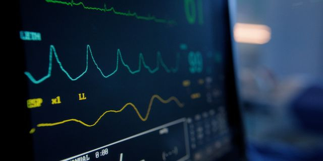 Πλήρωμα ιδιωτικού ασθενοφόρου έκλεψε καρδιογράφο από νοσοκομείο
