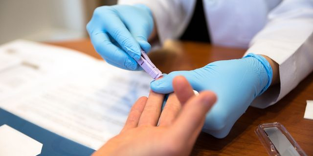 Εξέταση για τον ιό HIV