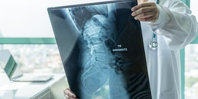 Γιατρός ελέγχει τις απεικονιστικές εξετάσεις ασθενούς με SMA