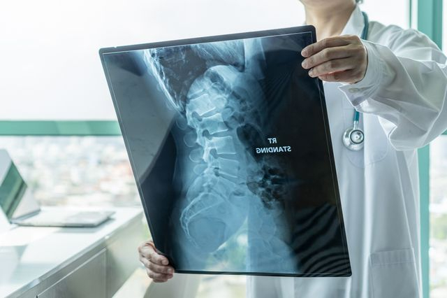 Γιατρός ελέγχει τις απεικονιστικές εξετάσεις ασθενούς με SMA