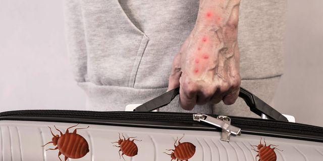 Χαρακτηριστικά τσιμπήματα κοριού