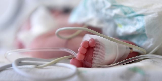 Λάρισα: Σε κρίσιμη κατάσταση το βρέφος που κάηκε από λάδι – Εξετάζεται η διακομιδή του