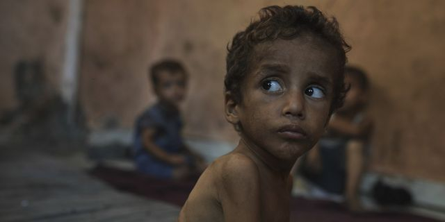 Ο Γιαζάν Αμπού Φουλ, ένα υποσιτισμένο παιδί δύο ετών, κάθεται στο σπίτι της οικογένειάς του στον προσφυγικό καταυλισμό Σατί στη Γάζα, την Τετάρτη 23 Ιουλίου 2025