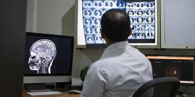 Γιατρός κοιτάζει ακτινογραφία εγκεφάλου