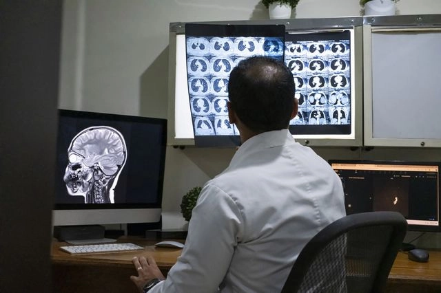 Γιατρός κοιτάζει ακτινογραφία εγκεφάλου