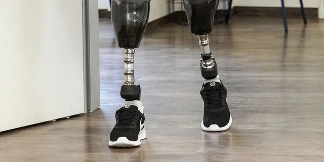 Χειρουργός έκοψε τα πόδια του για να ικανοποιήσει μια σεξουαλική εμμονή