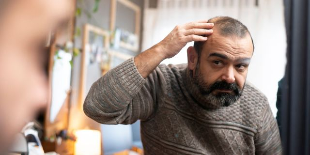 Τριχόπτωση