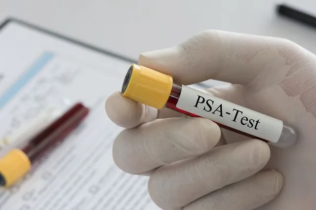 Τεστ PSA για τον καρκίνο του προστάτη