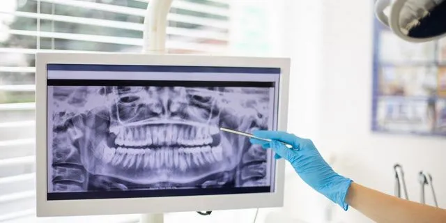 Γιατί τα δόντια δεν “λογαριάζονται” ως οστά