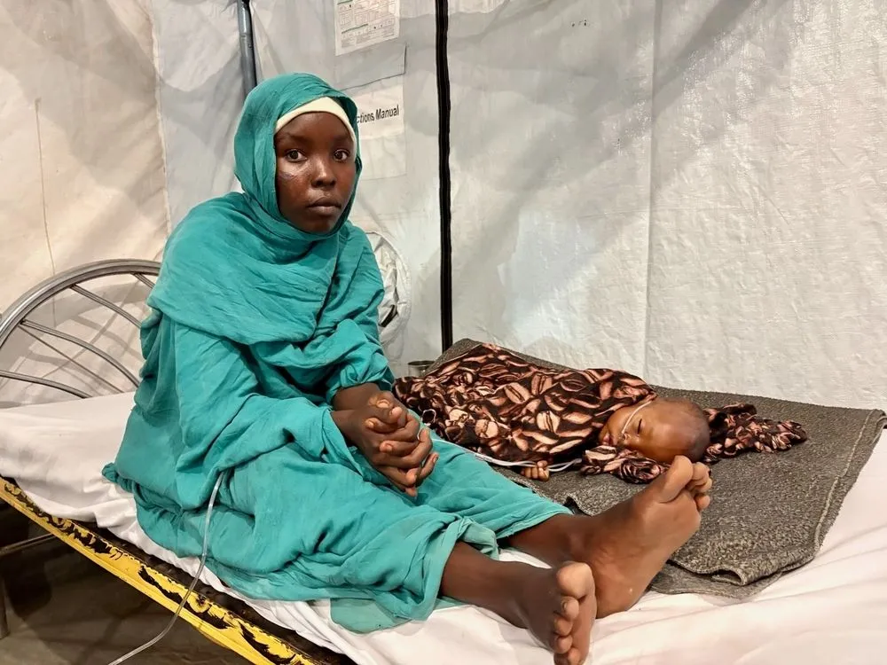 Ο Abdul Mazin Mahmoud, κάτω του ενός έτους, που πάσχει από σοβαρό οξύ υποσιτισμό