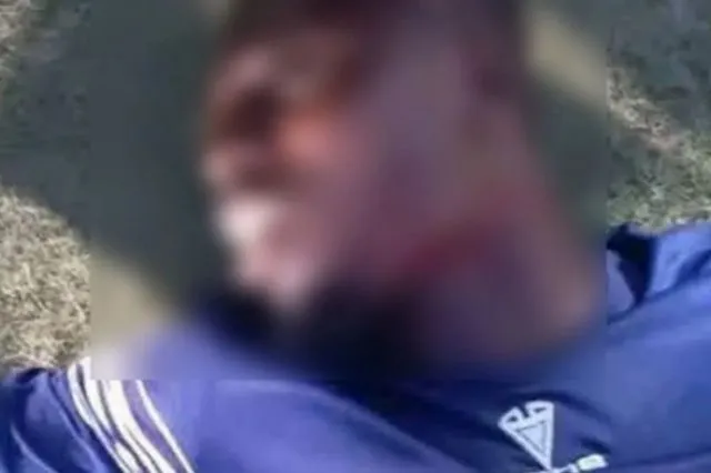 Οπαδός έκοψε τον λαιμό Γκανέζου ποδοσφαιριστή στον αγώνα Κατσίνα Γιουνάιτεντ – Μπαράου