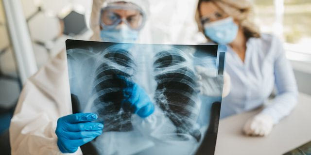 Υψηλά τα ποσοστά θνησιμότητας από αναπνευστικές λοιμώξεις στην Ελλάδα