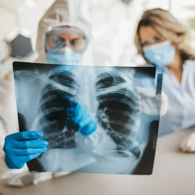 Υψηλά τα ποσοστά θνησιμότητας από αναπνευστικές λοιμώξεις