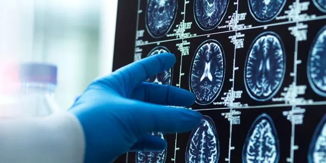 Μαγνητική τομογραφία εγκεφάλου