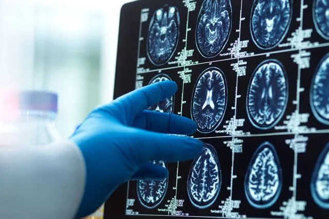 Μαγνητική τομογραφία εγκεφάλου