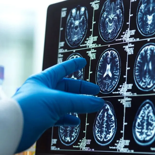Μαγνητική τομογραφία εγκεφάλου