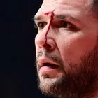 Μάτωσε στο πρόσωπο ο Παπανικολάου από αγκωνιά του Βοτιέ