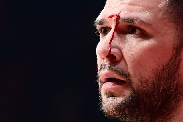 Μάτωσε στο πρόσωπο ο Παπανικολάου από αγκωνιά του Βοτιέ