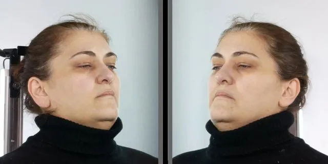 Αυτή είναι η οικιακή βοηθός που λήστευε ΑΜΕΑ και ηλικιωμένους