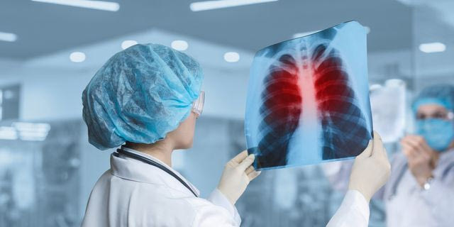 Γιατρός βλέπει τις ακτινογραφίες ασθενή