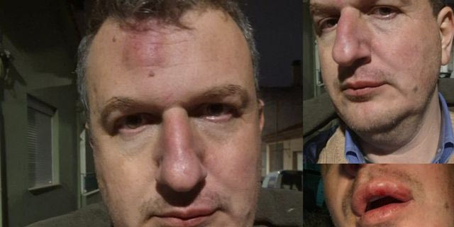 Βόλος: Χτύπησαν τον δημοσιογράφο και εκδότη Δημήτρη Καρεκλίδη