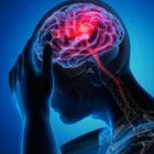 Απεικόνιση πόνου