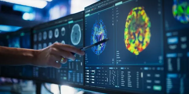 Γιατρός μελετά αξονική για όγκους