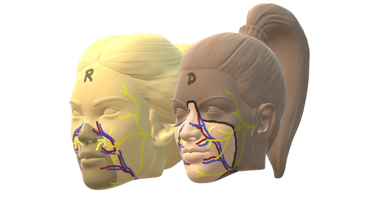 Ο σχεδιασμός πριν τη μεταμόσχευση