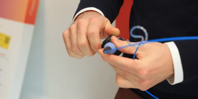 Νέα εποχή στην αντιμετώπιση της κολπικής μαρμαρυγής – Στην Ελλάδα η πλατφόρμα VARIPULSE