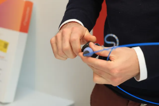 Νέα εποχή στην αντιμετώπιση της κολπικής μαρμαρυγής – Στην Ελλάδα η πλατφόρμα VARIPULSE