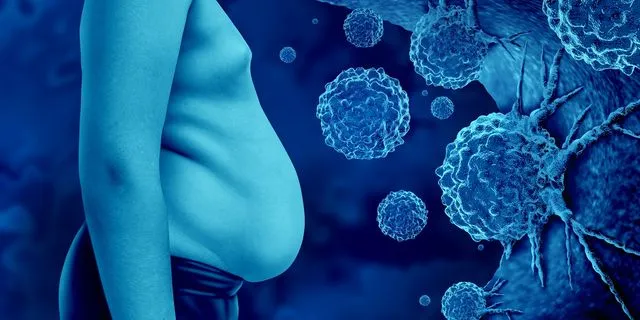 Παχυσαρκία και καρκίνος: τα κακοήθη καρκινικά κύτταρα σε ένα υπέρβαρο ανθρώπινο σώμα συνδέονται με αυξημένο κίνδυνο εμφάνισης ορισμένων μορφών καρκίνου λόγω γενετικών παραγόντων ή επιλογών τρόπου ζωής.