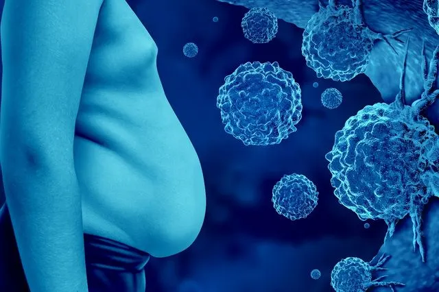 Παχυσαρκία και καρκίνος: τα κακοήθη καρκινικά κύτταρα σε ένα υπέρβαρο ανθρώπινο σώμα συνδέονται με αυξημένο κίνδυνο εμφάνισης ορισμένων μορφών καρκίνου λόγω γενετικών παραγόντων ή επιλογών τρόπου ζωής.