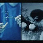 Η “βιομηχανία” των χειρουργικών αμβλώσεων στην Ελλάδα