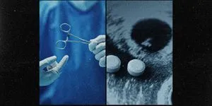 Η “βιομηχανία” των χειρουργικών αμβλώσεων στην Ελλάδα