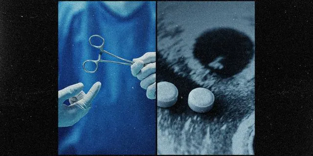 Η “βιομηχανία” των χειρουργικών αμβλώσεων στην Ελλάδα