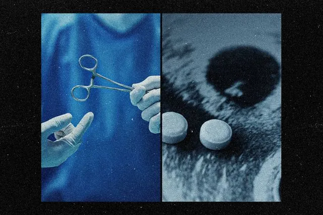 Η “βιομηχανία” των χειρουργικών αμβλώσεων στην Ελλάδα