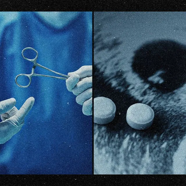 Η “βιομηχανία” των χειρουργικών αμβλώσεων στην Ελλάδα