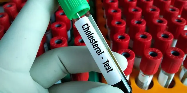 Εξέταση χοληστερίνης