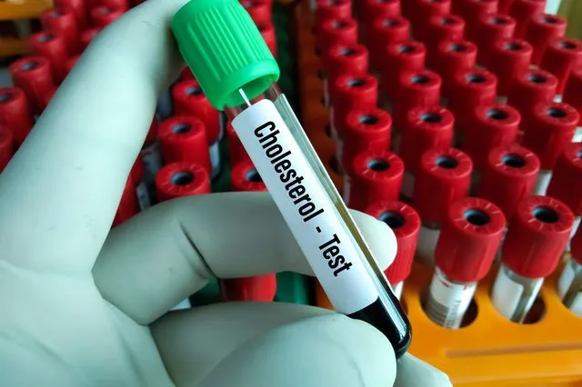 Εξέταση χοληστερίνης