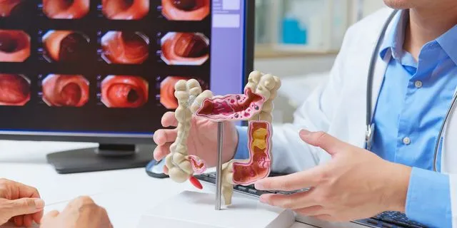 Γιατρός χρησιμοποιεί ένα μοντέλο του παχέος εντέρου για να εξηγήσει τη διάγνωση του καρκίνου του εντέρου.