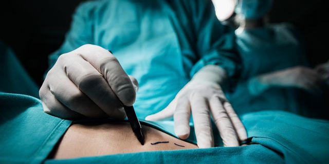 Σε ποιο σημείο του σώματος έγινε η πρώτη επέμβαση πλαστικής χειρουργικής