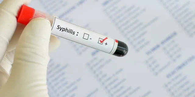 Syphilis positive