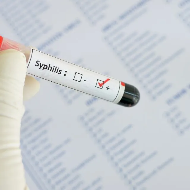 Syphilis positive