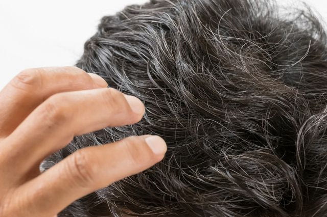 Δεν γκριζάρεις, αλλά ασπρίζεις – Γιατί σε ξεγελάει ο καθρέφτης