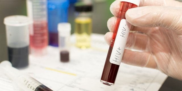 Φίτζι: Σε κατάσταση εθνικής κρίσης λόγω HIV – Ένας στους 60 έχεις AIDS