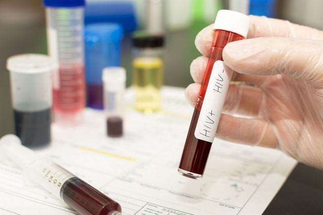 Φίτζι: Σε κατάσταση εθνικής κρίσης λόγω HIV – Ένας στους 60 έχεις AIDS