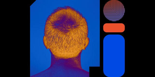 Μπορεί μια μεσοθεραπεία να επιβραδύνει την τριχόπτωση;